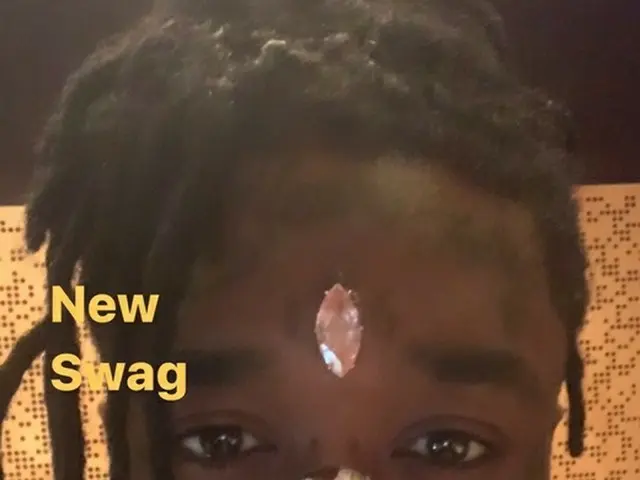 Rapper Amerika Lil Uzi Vert mengungkapkan bahwa berlian bertatahkan di dahinya d