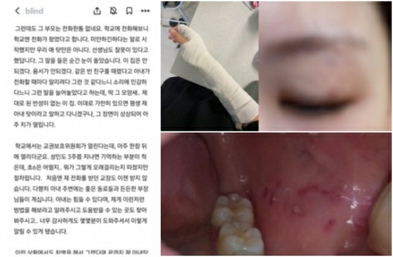 Siswa kelas 6 'menyerang' guru perempuan... 'Gugatan' guru terhadap orang tua = Korea Selatan