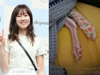 Kecerobohan aktris Kong Hyo Jin menyebabkan anjing peliharaannya mengalami kecelakaan