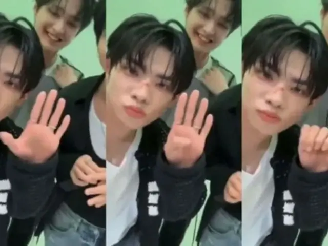 Idol mengirimkan "isyarat tangan untuk menyampaikan SOS" selama siaran langsung...Penggemar mengatakan "Ini bukan sesuatu yang harus kita abaikan begitu saja"